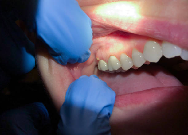 Best Weekend Emergency Dentist in Alum Creek, WV
